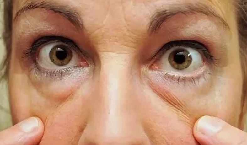 ��� ���������� � �������: ���������� ������� � �������� ��������